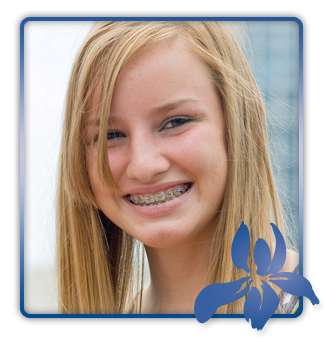 stock photo young teen girl wearing braces